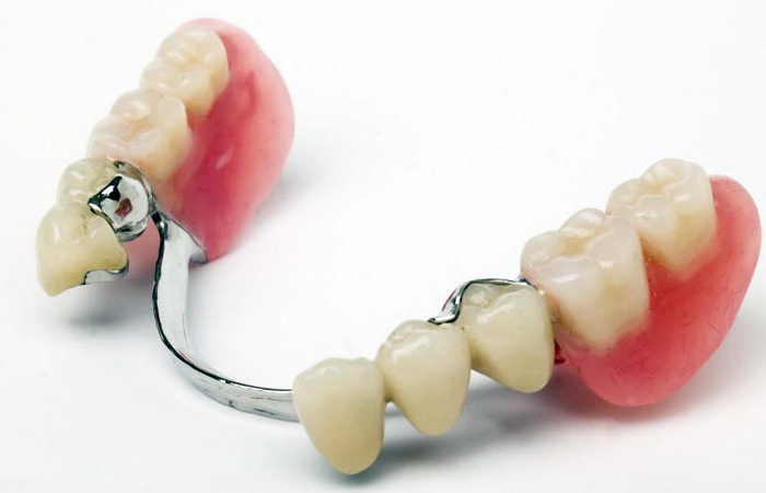 پروتز متحرک دندان