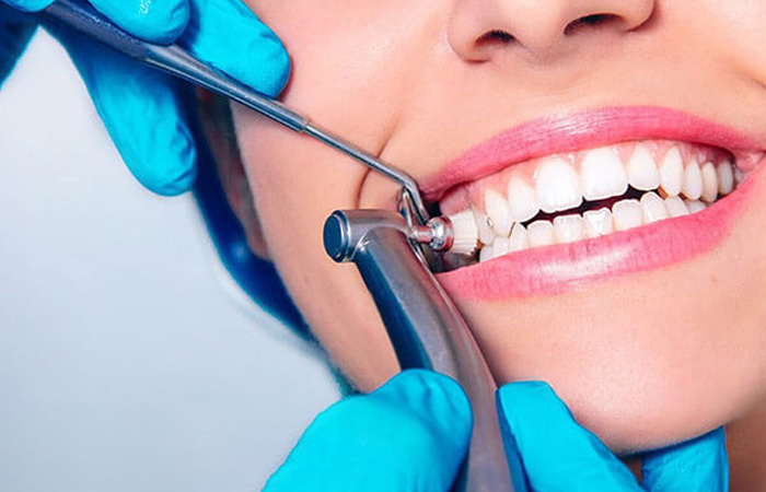 هزینه عصب کشی دندان ، هزینه عصب کشی دندان با بیمه تامین اجتماعی ، قیمت عصب کشی و روکش دندان ، قیمت عصب کشی و روکش دندان ، عصب کشی دندان