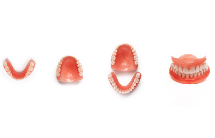 راهنمای کامل درباره دست دندان در مشهد