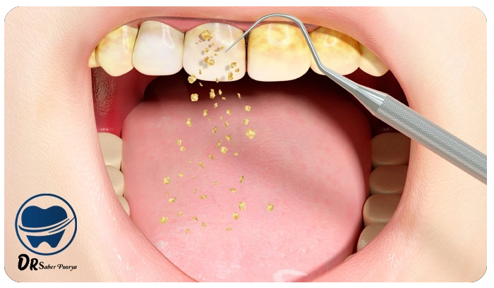 هزینه جرمگیری