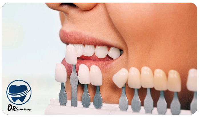 حساسیت بعد از بلیچینگ