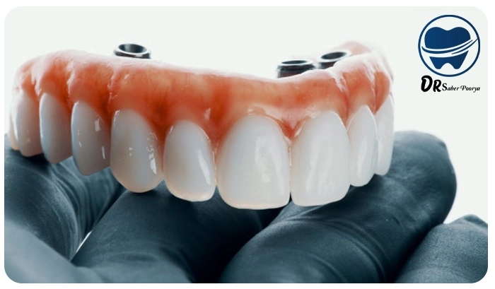 دندان مصنوعی در مشهد