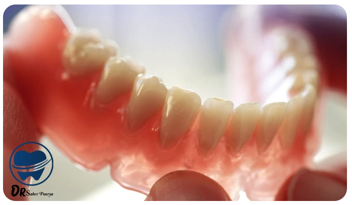 قیمت دندان مصنوعی در مشهد