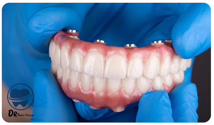 پروتز دندان در مشهد