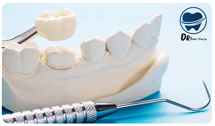 پروتز کامل یا جزئی دندان