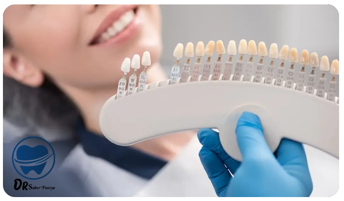 کامپوزیت دندان در مشهد