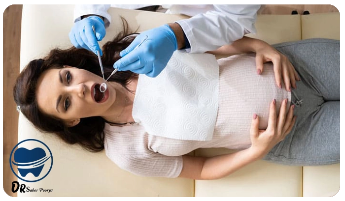 ایمپلنت دندان بارداری