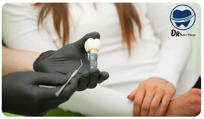 ایمپلنت در دوران بارداری