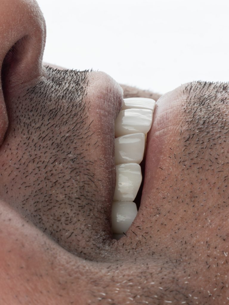 ونیر کامپوزیت مشهد و ایمپلنت دکتر صابر پوریا رضائی