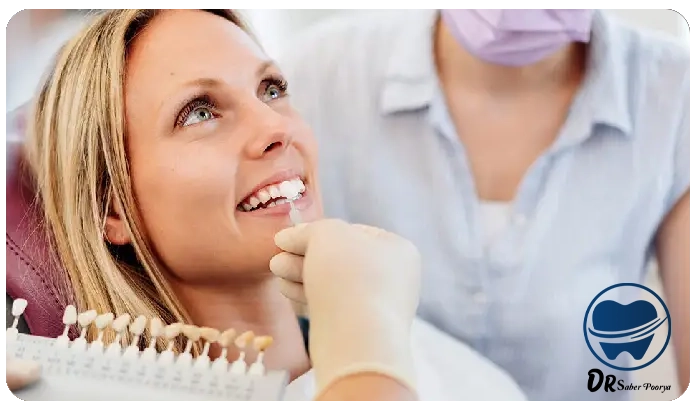 لمینت دندان بهتر است یا کامپوزیت