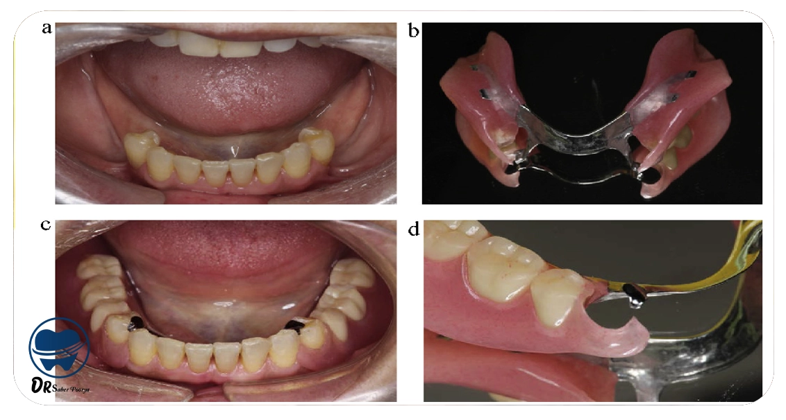 پروتز دندان مشهد