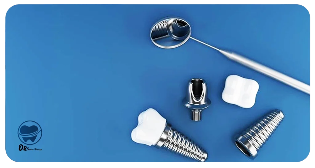 اجزای تشکیل دهنده ایمپلنت دندان
