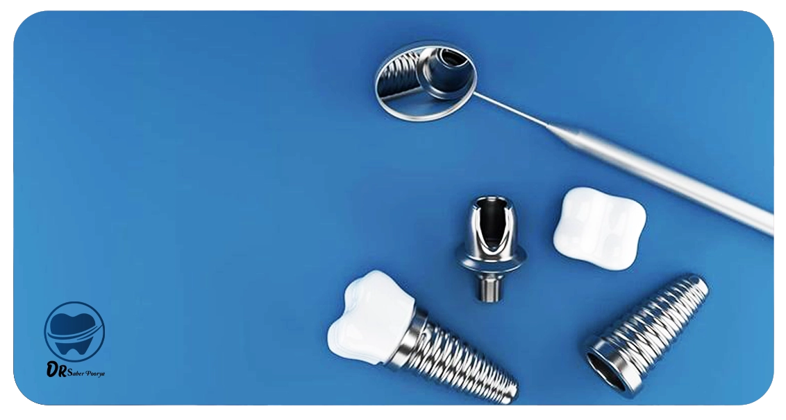 اجزای تشکیل دهنده ایمپلنت دندان