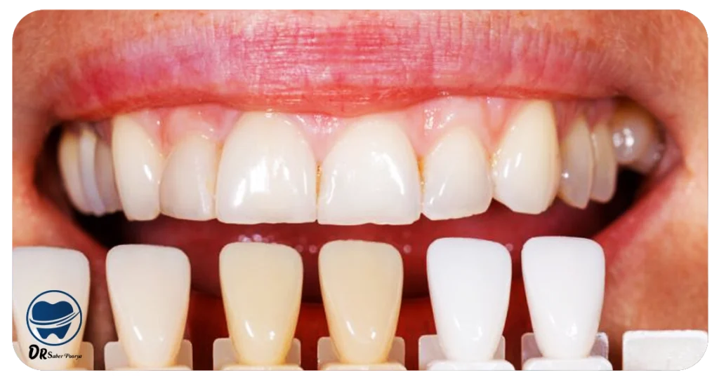 دکتر کامپوزیت مشهد