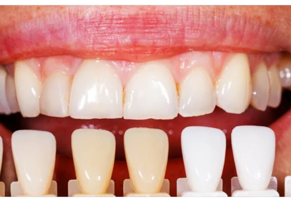 دکتر کامپوزیت مشهد