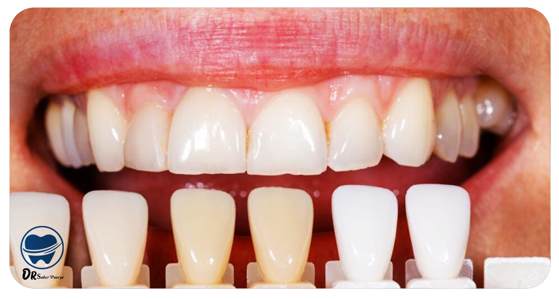 دکتر کامپوزیت مشهد