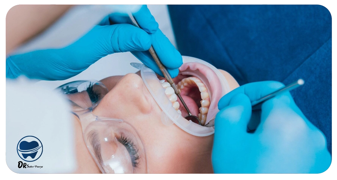 قیمت لمینت در مشهد