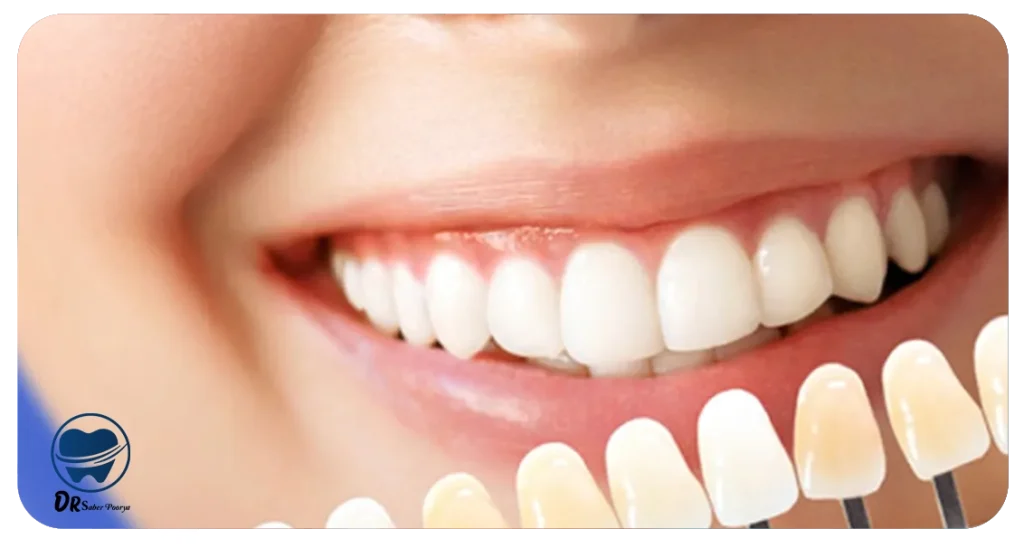 بهترین متخصص لمینت در مشهد