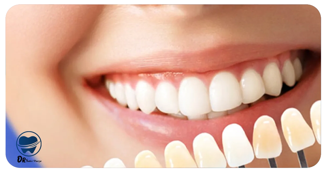 بهترین متخصص لمینت در مشهد