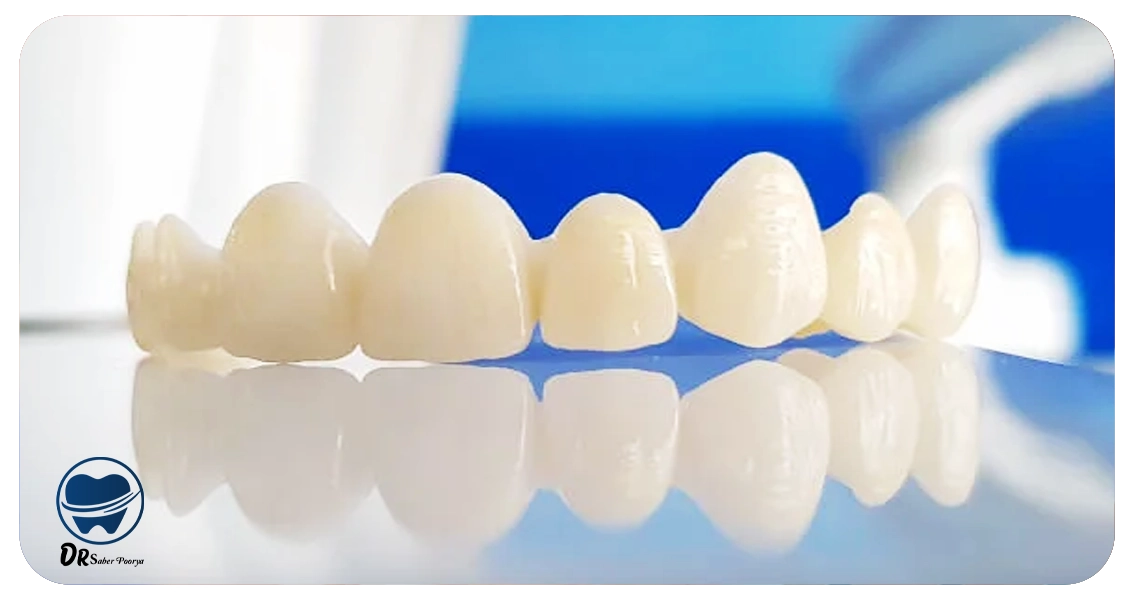 نمونه کار لمینت در مشهد