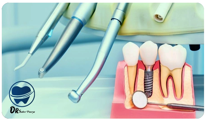 مراقبت‌های بعد از عمل جراحی ایمپلنت