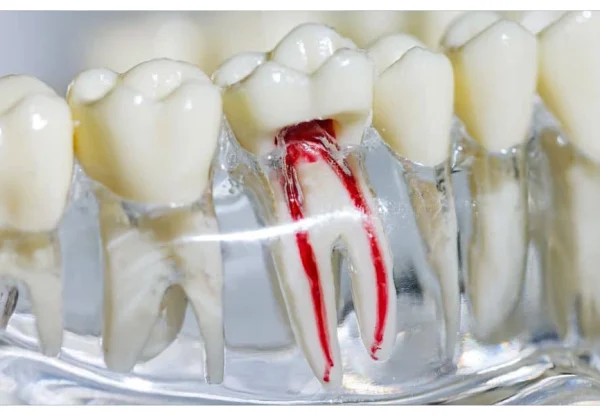 بهترین متخصص درمان ریشه در مشهد