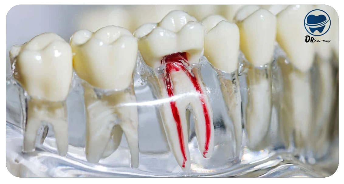 بهترین متخصص درمان ریشه در مشهد